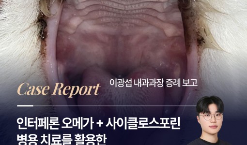 인터페론 오메가 + 사이클로스포린…